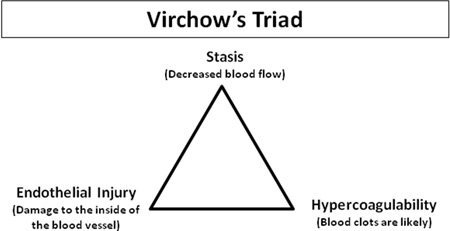 Virchow's Triad - the three things that lead to a blood clot